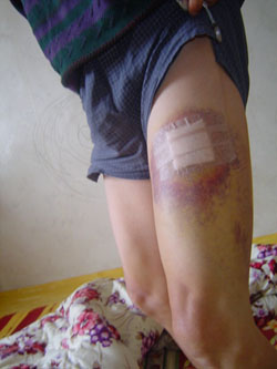 홍콩경찰 "살상무기 고무탄 사용했다"